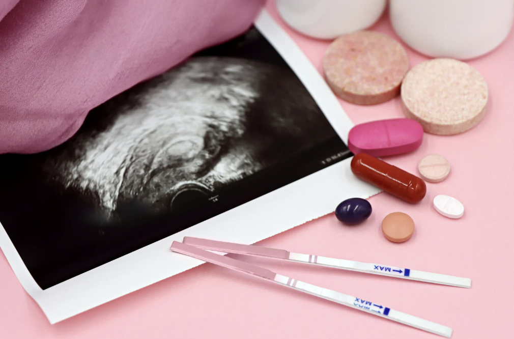 contraception hormonale